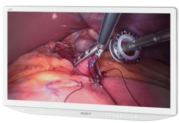 Sony LMDX550MD 55″ 4K Surgical Monitor